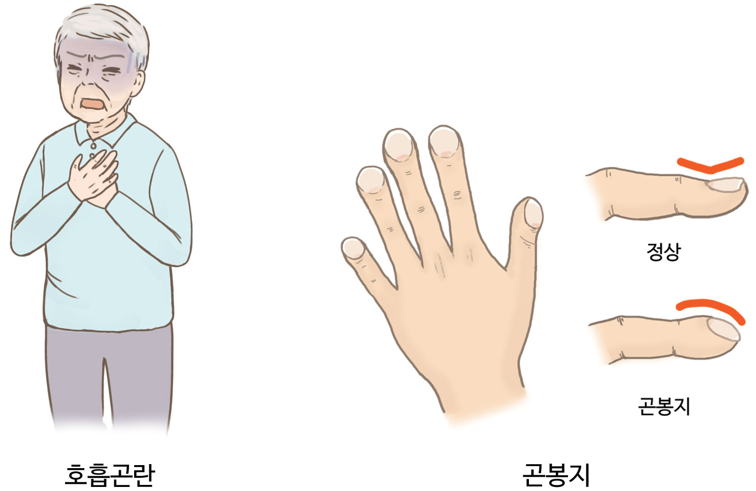 팝업 이미지