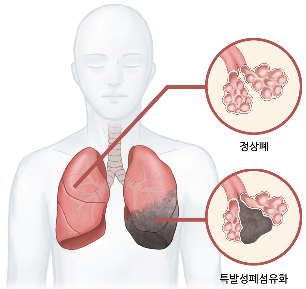 팝업 이미지